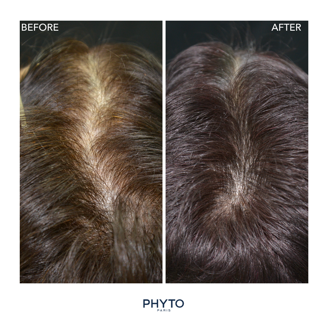 PHYTO USA