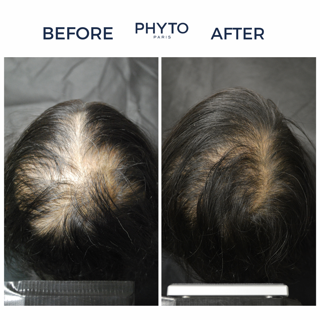 PHYTOCYANE Densifying Treatment for Progressive Hair Thinning - Women
